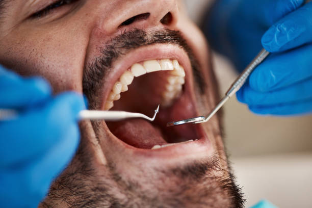 Fast & Reliable Emergency Dental Services in CA